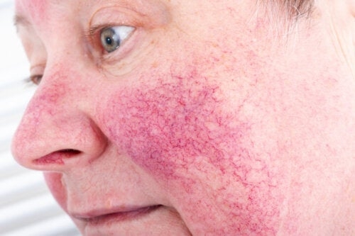 15 распространенных кожных заболеваний и способы их лечения