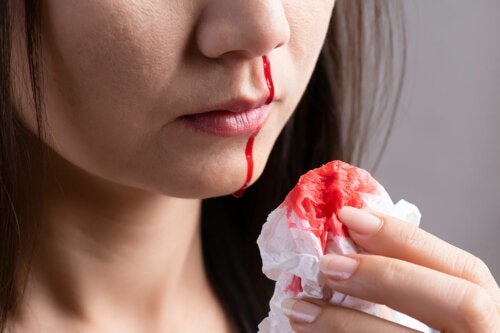 У вас часто идет кровь из носа? узнать почему